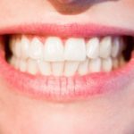 Śliczne nienaganne zęby dodatkowo godny podziwu uroczy uśmieszek to powód do zadowolenia.